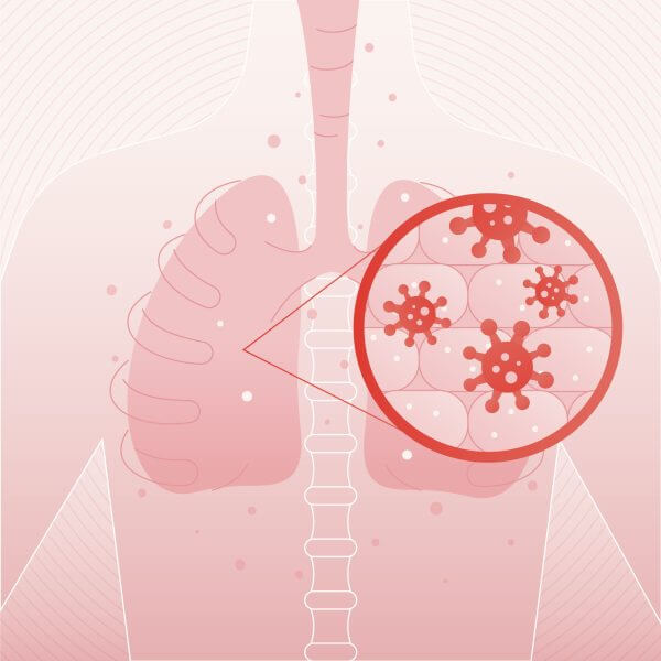 gripe e resfriado (7)